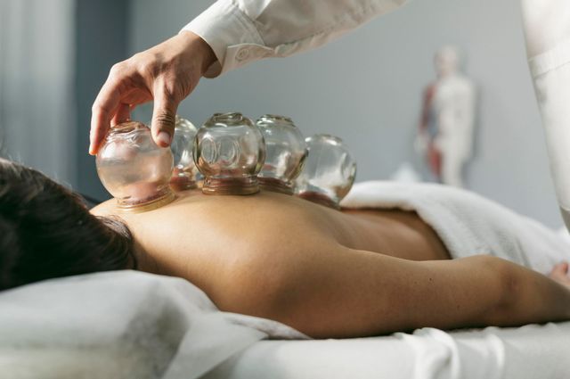 Client receiving cupping treatment