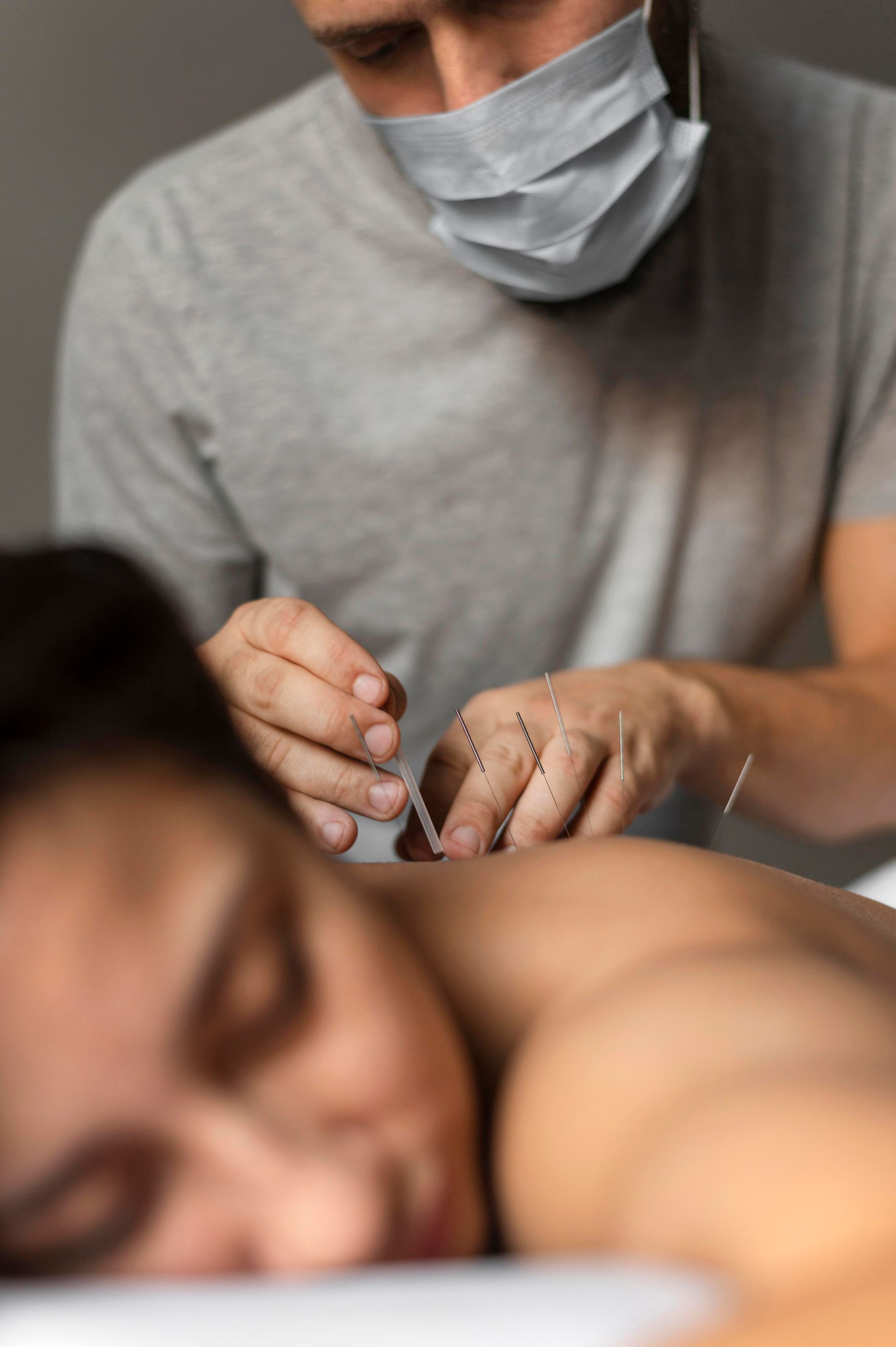 A man wearing a mask is giving an acupuncture treatment to a woman