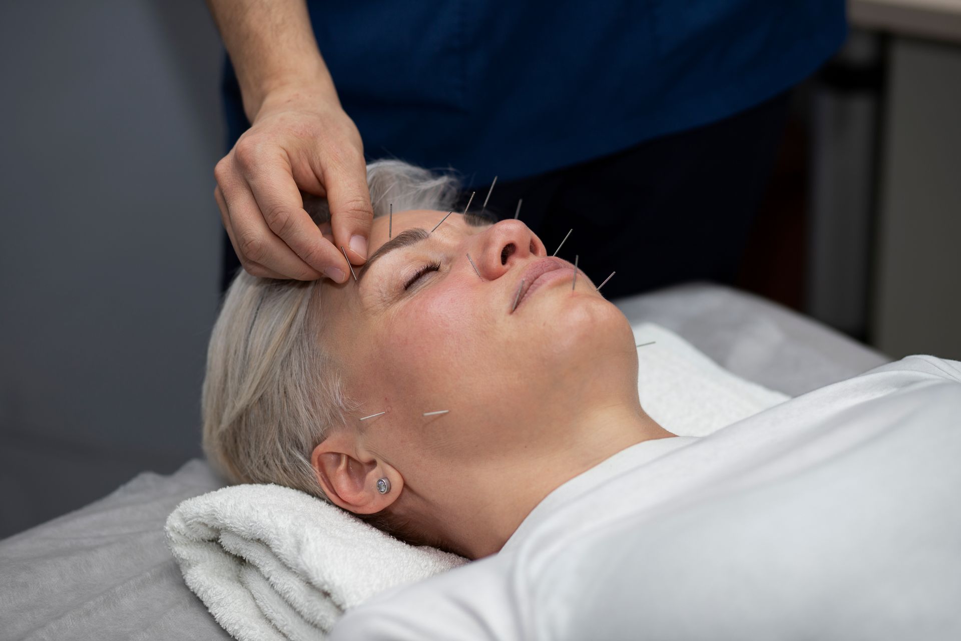 A woman is getting acupuncture on her face