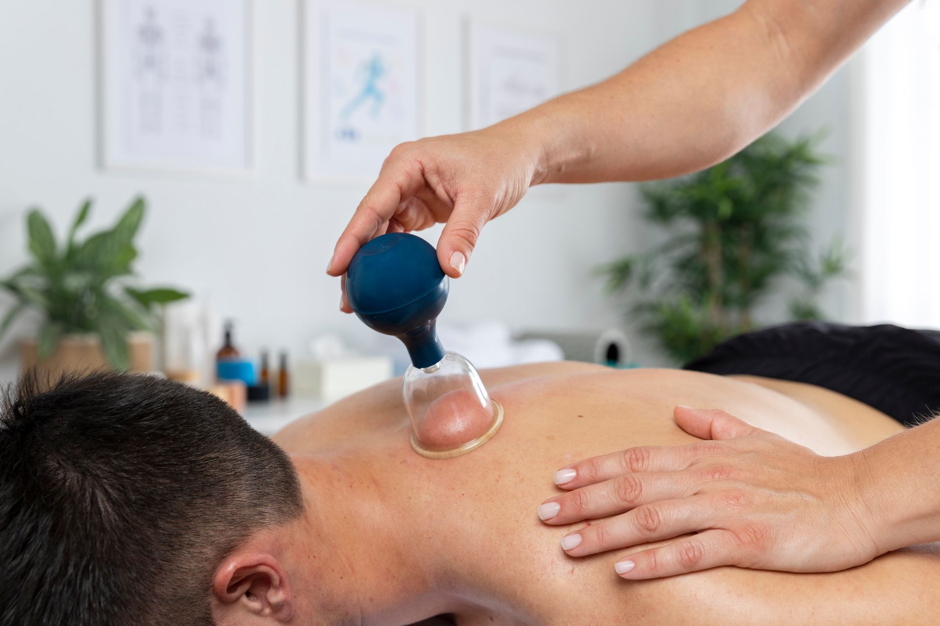 A man is getting a cupping treatment on his back