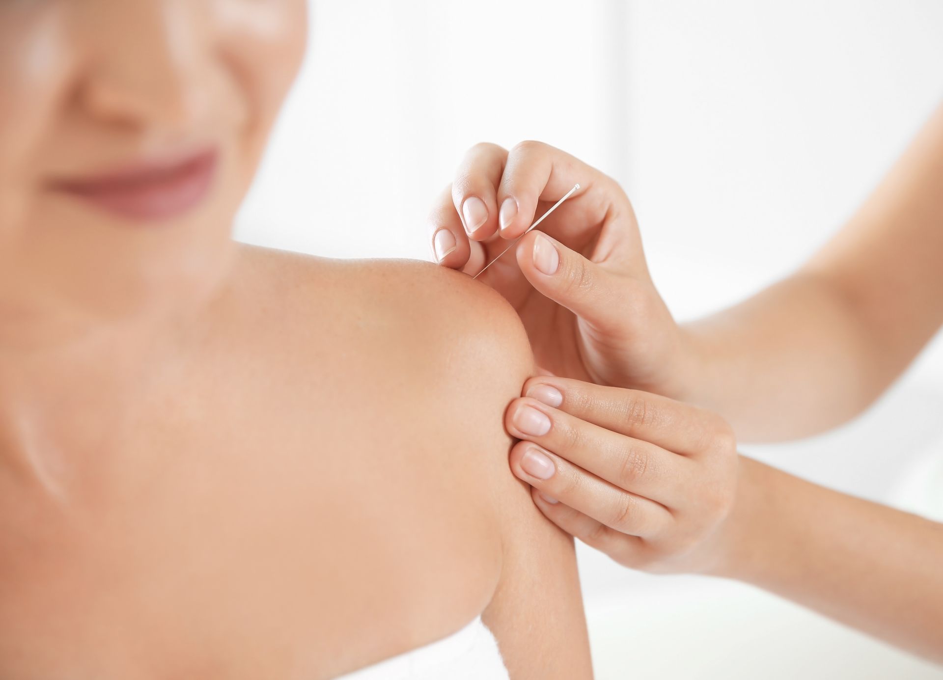 A woman is getting acupuncture on her shoulder