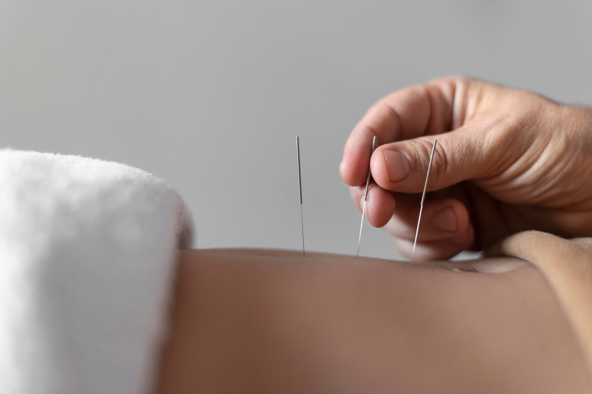 Understanding Cyclic Fertility Acupuncture with Easy@Home BBT